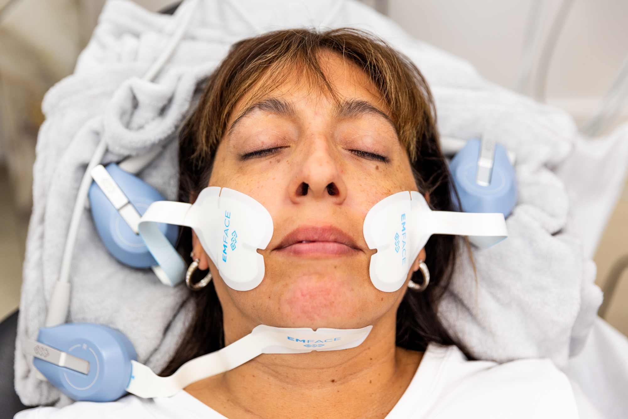 Close up of a woman getting Emface near Windermere, FL.